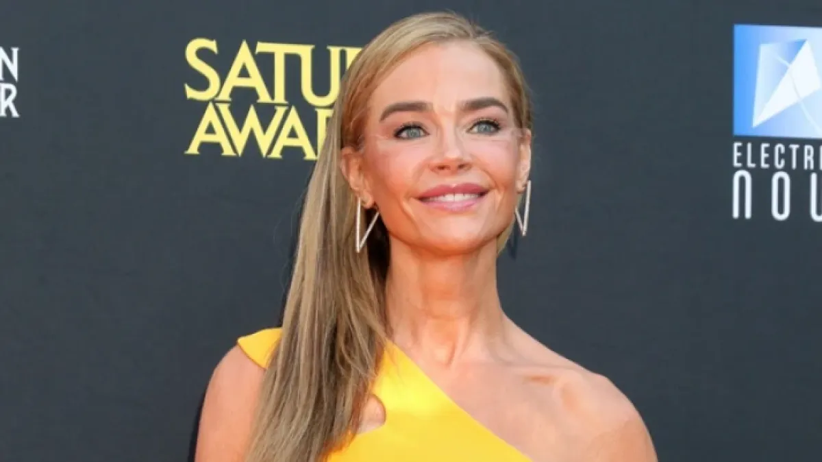 Denise Richards objavila fotografije prije i poslije estetskog zahvata: 'Bila sam prestravljena'