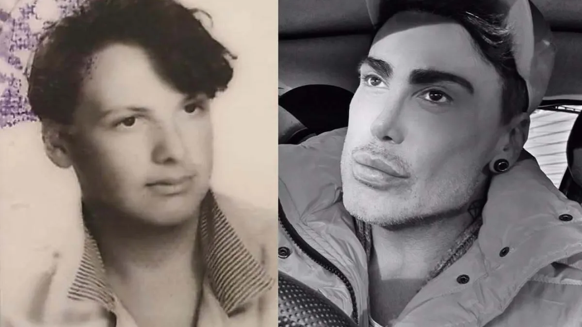 Operirao sve, od kapaka do jagodica! Pogledajte kako je Neven Ciganović izgledao u mladosti