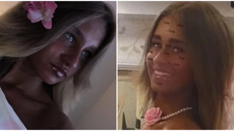 Ovisna je o solariju već pet godina i ne može se toga rije&scaron;iti: Nećete vjerovati koliko je tamna