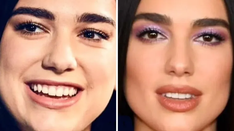 Pogledajte kako je Dua Lipa izgledala prije nego što je postala svjetska zvijezda