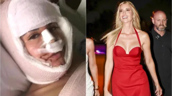 Ona je Ivanka Trump s Temua: Potrošila masne pare na operacije sve dok kirurg nije rekao dosta