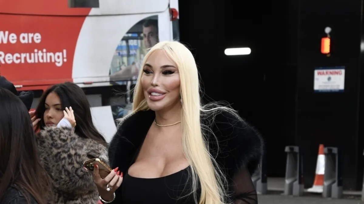 Nevjerojatna transformacija: Sad je bila uzbuđena, a pogledajte kako je prije izgledala Kép