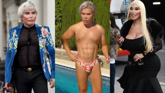 Nevjerojatna transformacija: Sad je bila uzbuđena, a pogledajte kako je prije izgledala