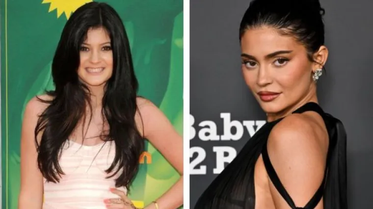 Da, to je Kylie Jenner ! Prepoznajete li ju? Ovako je izgledala prije odlaska pod nož