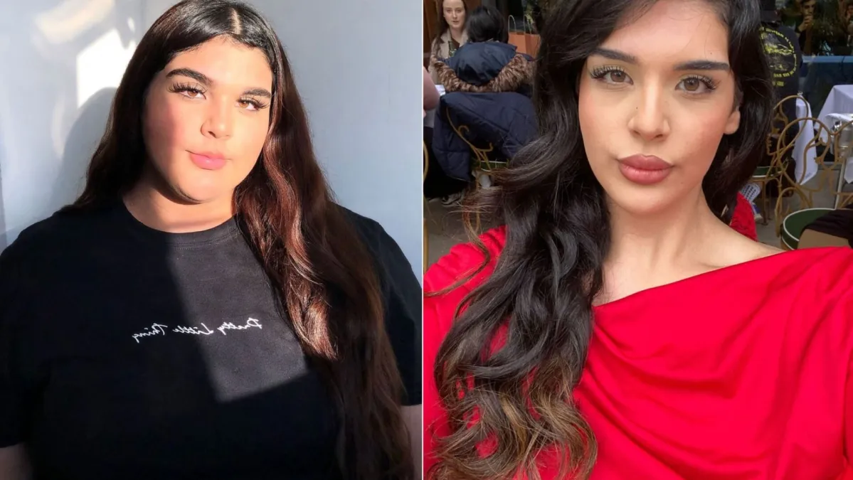 Smršavjela 40 kilograma, no hejteri je zlostavljaju: 'Optužuju me da koristim injekcije'