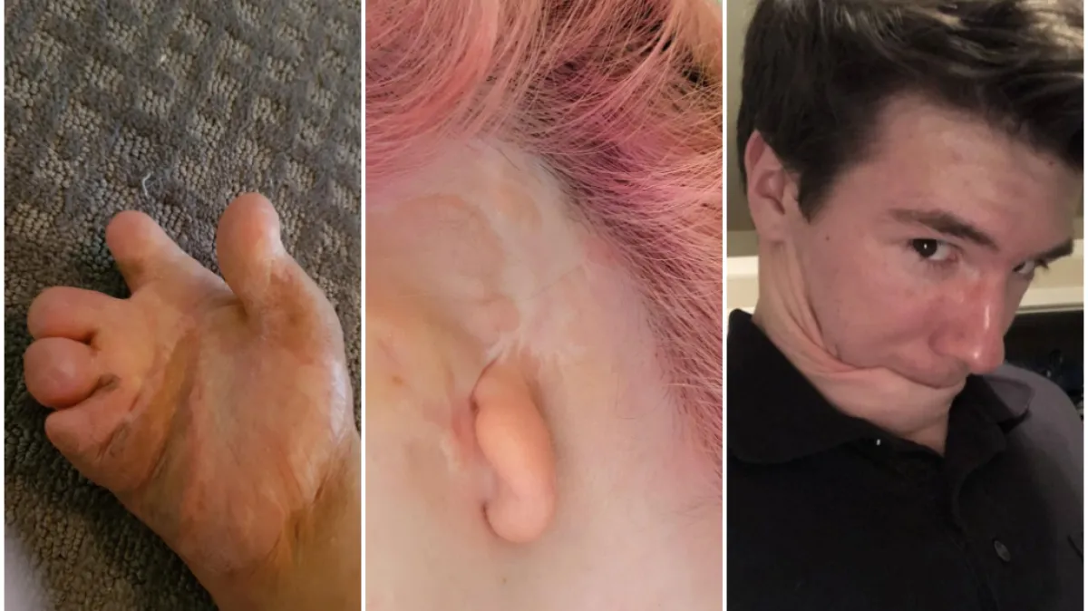 Ovi ljudi rođeni su da bi se isticali u gomili: Njihove anomalije doista su nevjerojatne