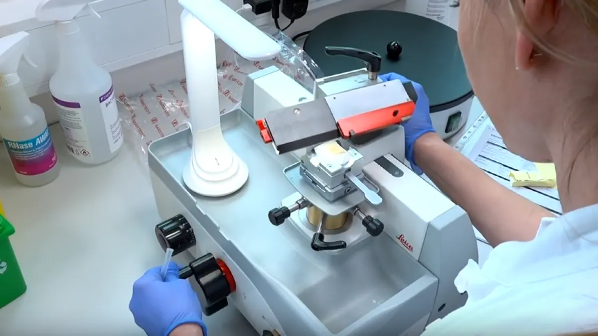 Revolucija u liječenju raka: 'Da sam se 10 godina rodila ranije, ništa od ovog ne bi bilo'