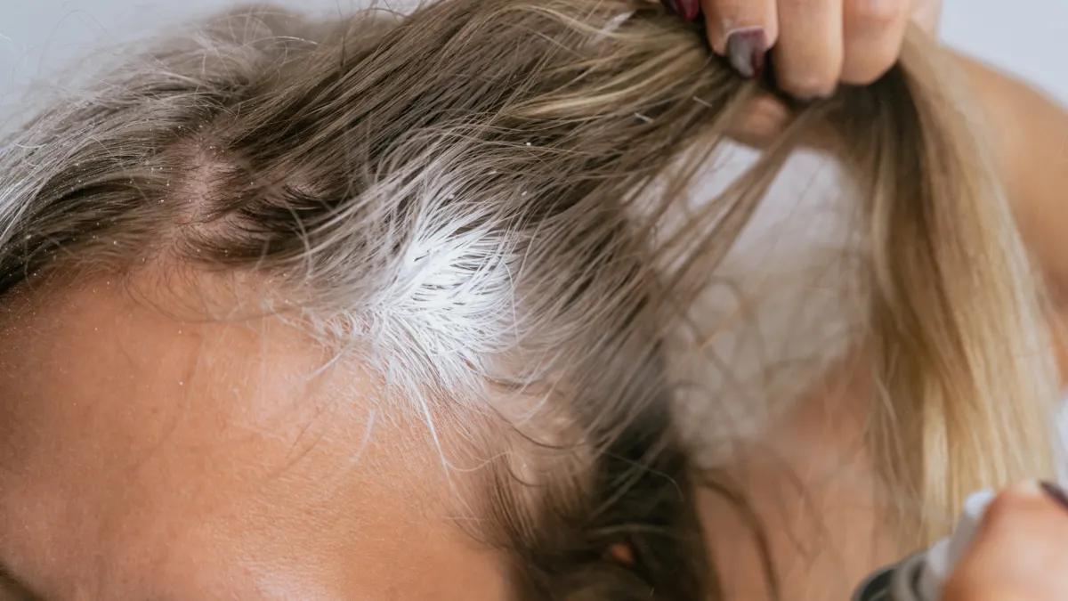 I vi ovako 'perete kosu'? Evo zašto ćete dvaput promisliti prije nego što to opet napravite