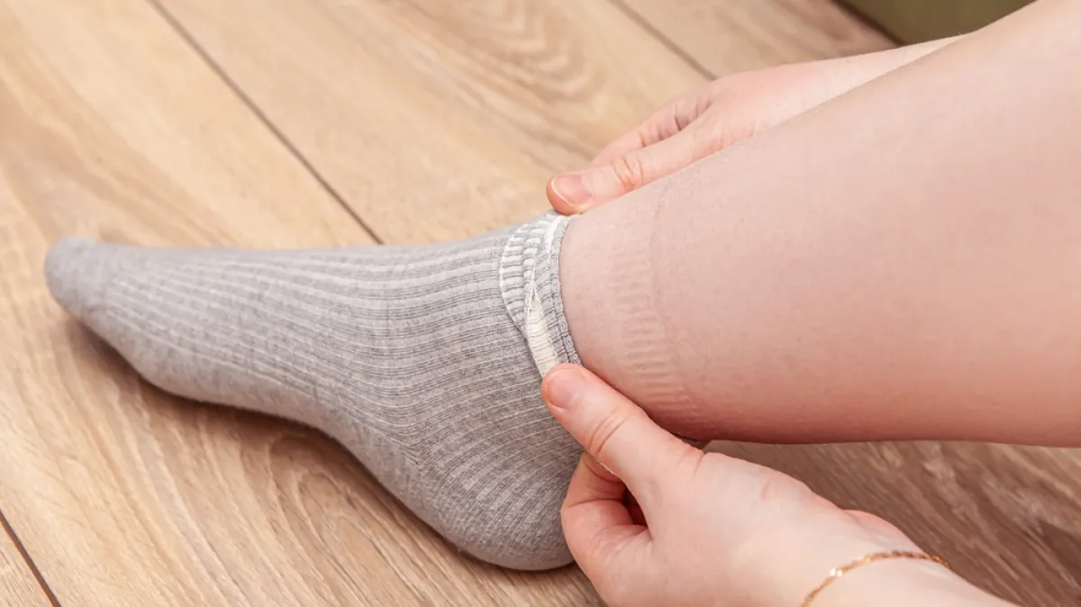 Čarape vam ostavljaju tragove na nogama? Liječnici otkrivaju što to znači i je li opasno