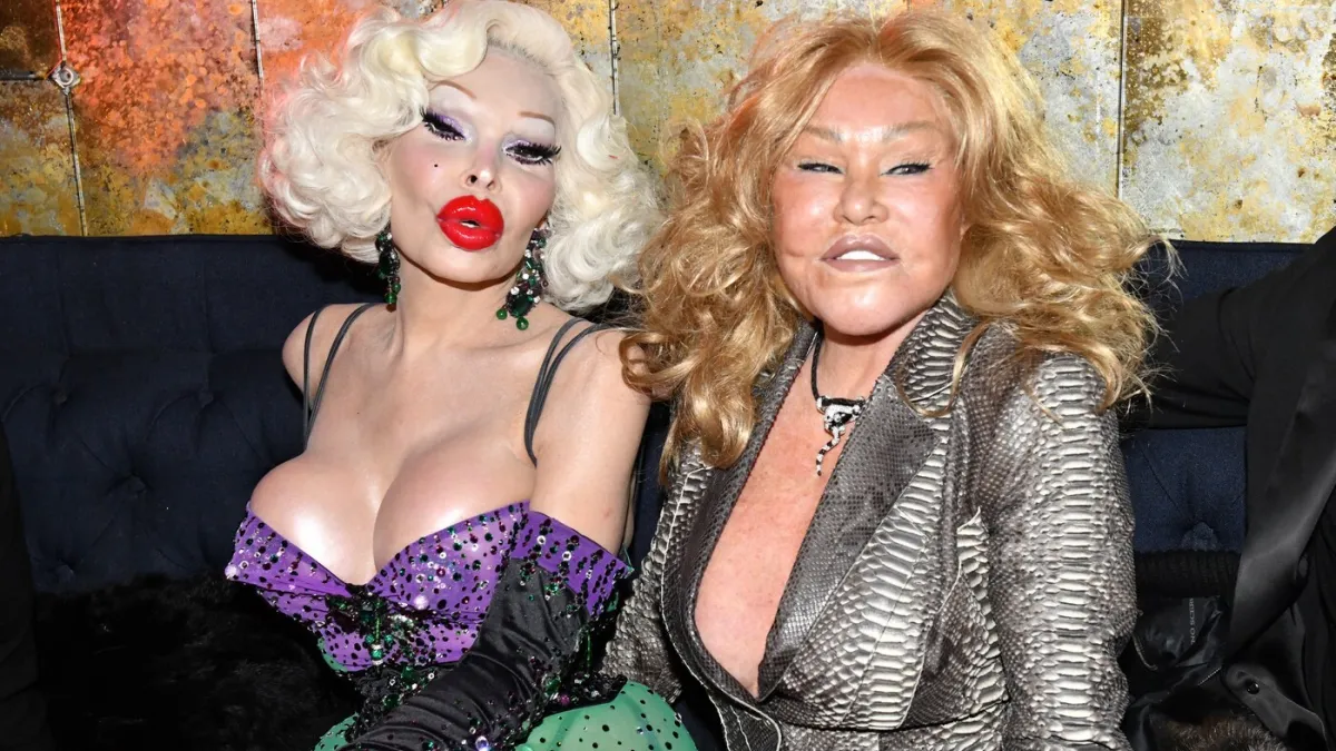 Slavni koji su otišli pod nož i zauvijek unakazili svoja lica: Sada izgledaju neprepoznatljivo