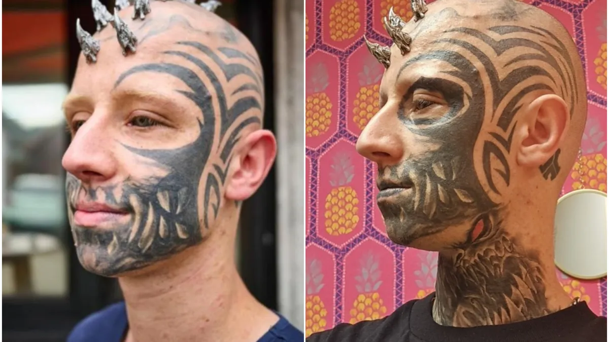 Slijepi muškarac s metalom u glavi i crnim očima šokira pojavom: Evo kako je izgledao prije